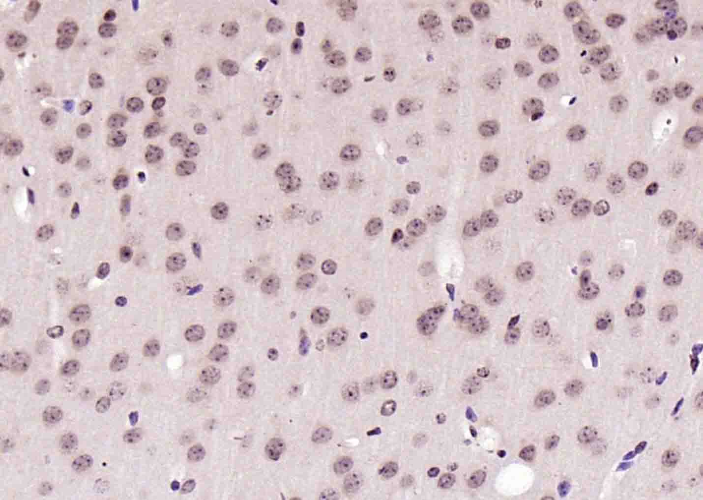 RNA polymerase II Rabbit pAb(b