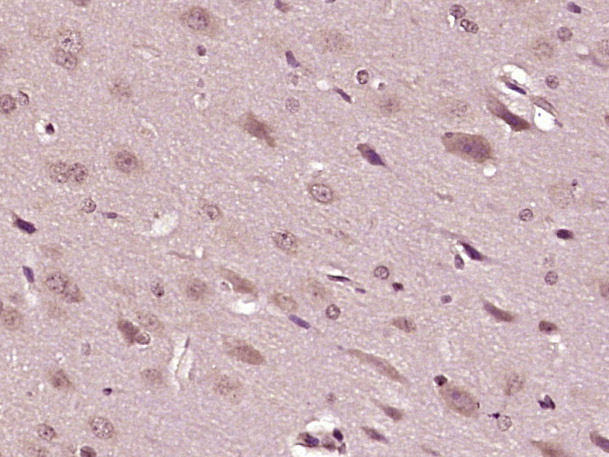 BMPER Rabbit pAb(bs-6910R)-50u