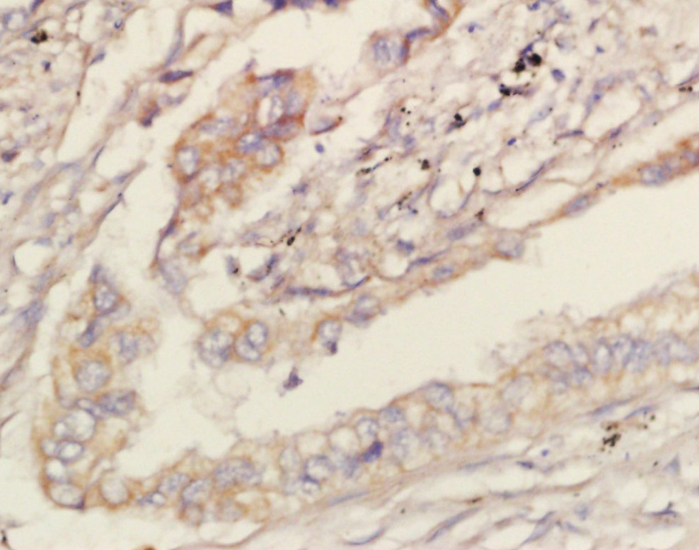 LPCAT2 Rabbit pAb(bs-10742R)-5