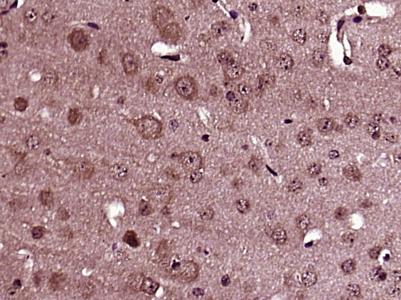 Presenilin 1 + 2 Rabbit pAb(bs