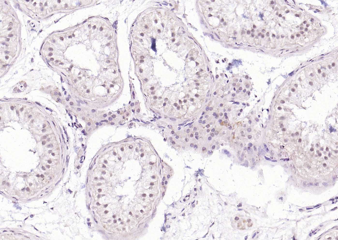 HSF1 Rabbit pAb(bs-3757R)-50ul