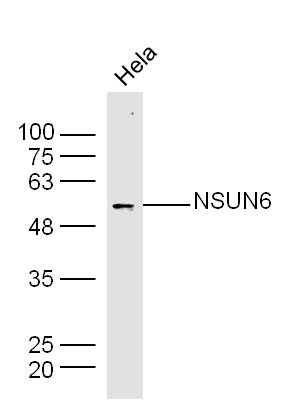 NSUN6 Rabbit pAb(bs-19484R)-50