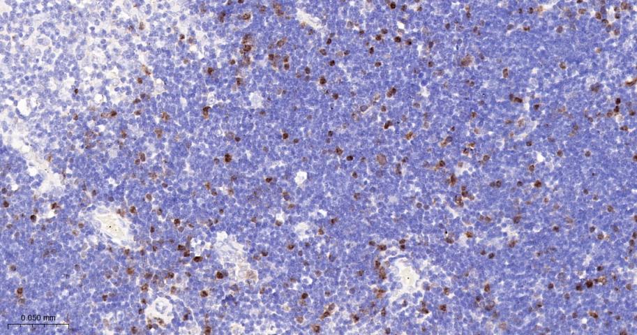 CCNA2 Recombinant Rabbit mAb(b