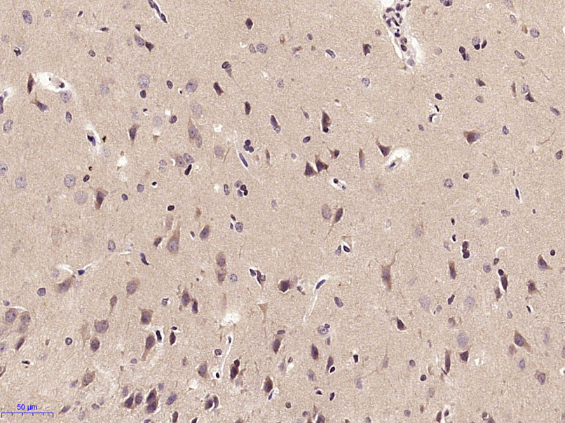 SPARCL1 Rabbit pAb(bs-6110R)-5