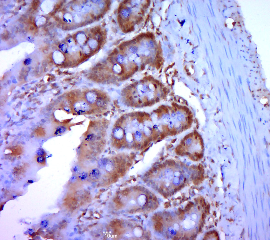 Eps8L3 Rabbit pAb(bs-14615R)-5