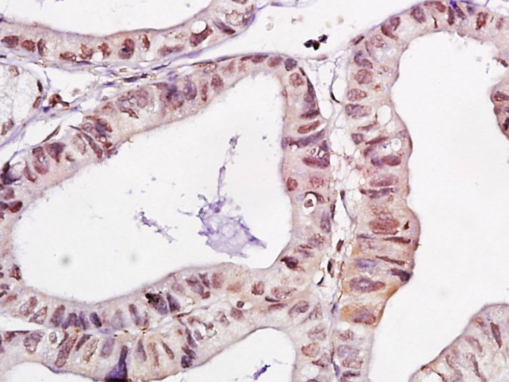 WWOX Rabbit pAb(bs-0589R)-50ul