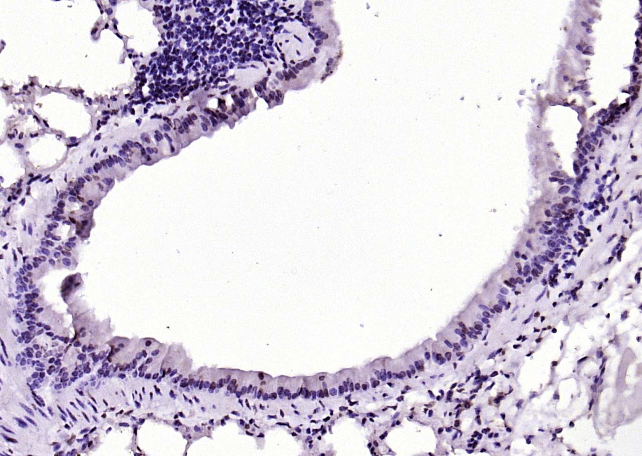 SIK1 Rabbit pAb(bs-6252R)-50ul