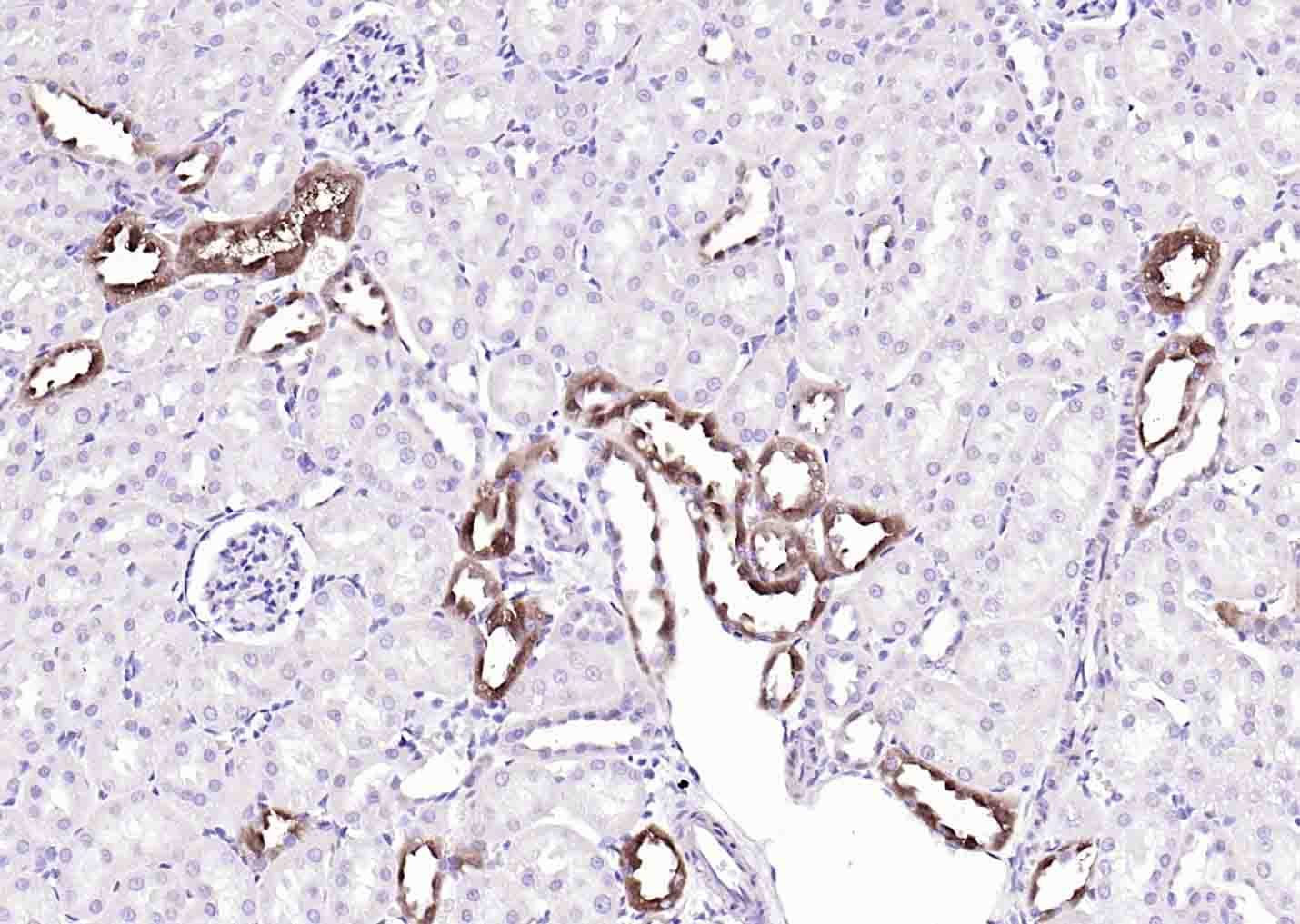MGAT5 Rabbit pAb(bs-5841R)-50u