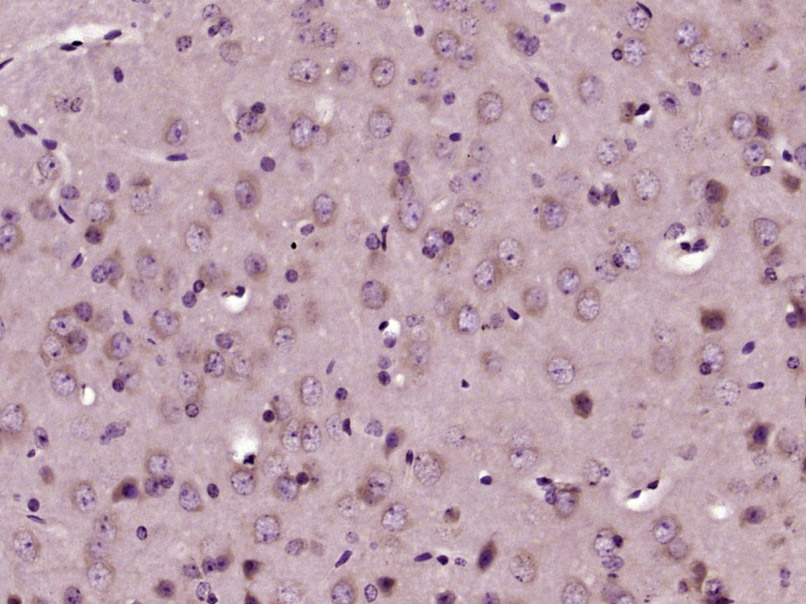 RBM33 Rabbit pAb(bs-21295R)-50