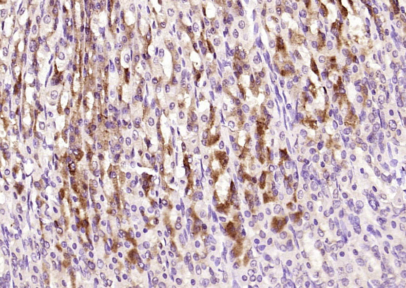 GALT Rabbit pAb(bs-3984R)-50ul