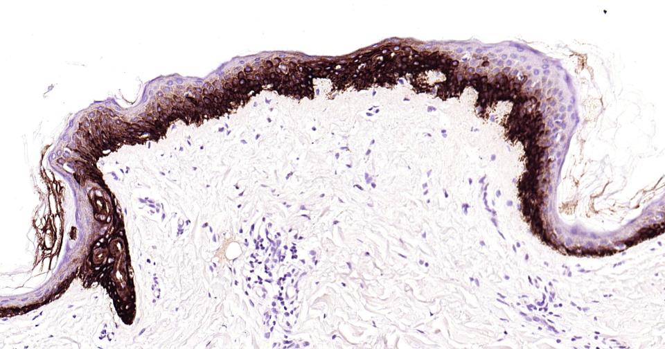 Cytokeratin 14 Recombinant Rab