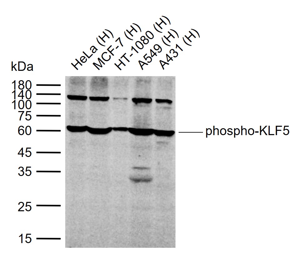 phospho-KLF5 (Ser275) Rabbit p