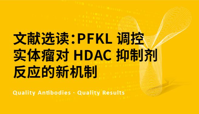 文献选读：PFKL 调控实体瘤对 HDAC 抑制剂反应的新机制