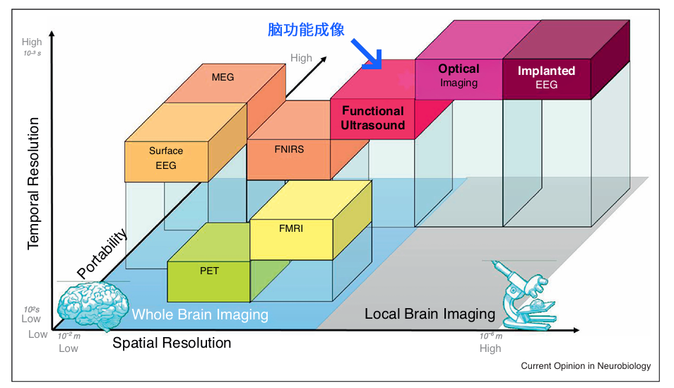 脑功能成像新利器：fUS超声技术实时解码全脑活动，赋能神经疾病与脑机接口研究