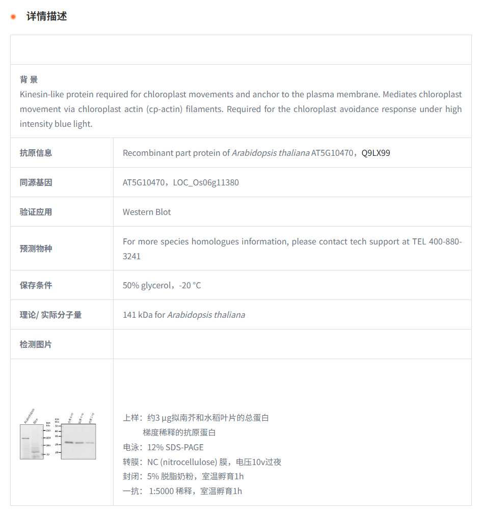 【植物抗体】Anti-KAC1/KIN14A/ Kinesi