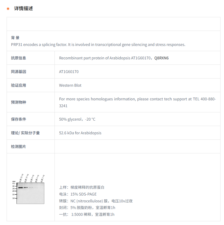 【植物抗体】Anti-PRP31/ U4/U6 small