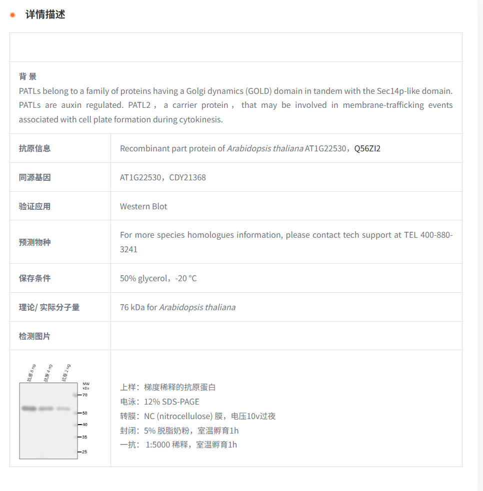 【植物抗体】Anti-PATL2/ Patellin-2