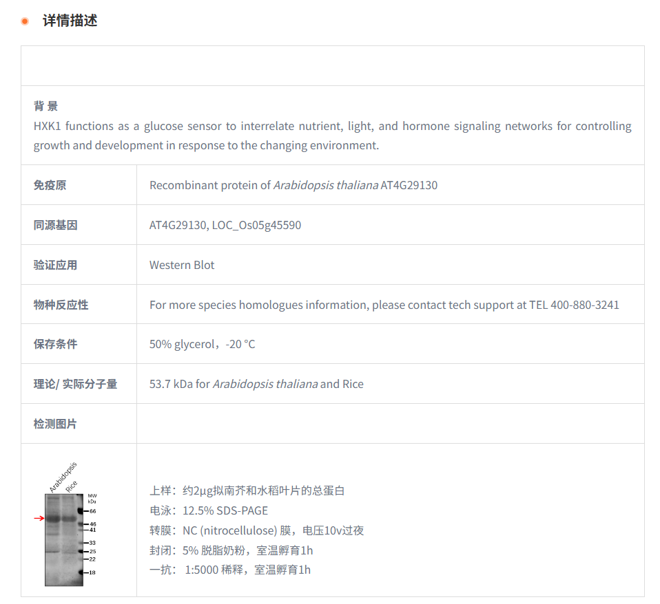 【植物抗体】Anti-HXK1/ Hexokinase-1 
