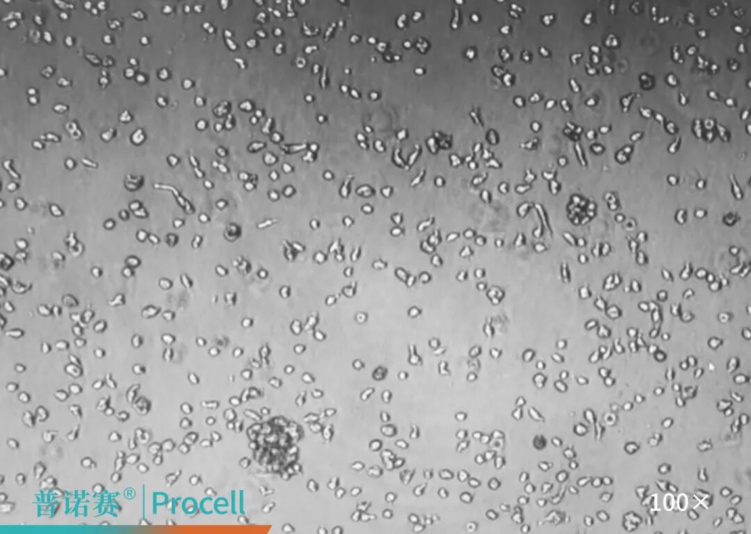 MCF 10A细胞传代后消化重铺图像