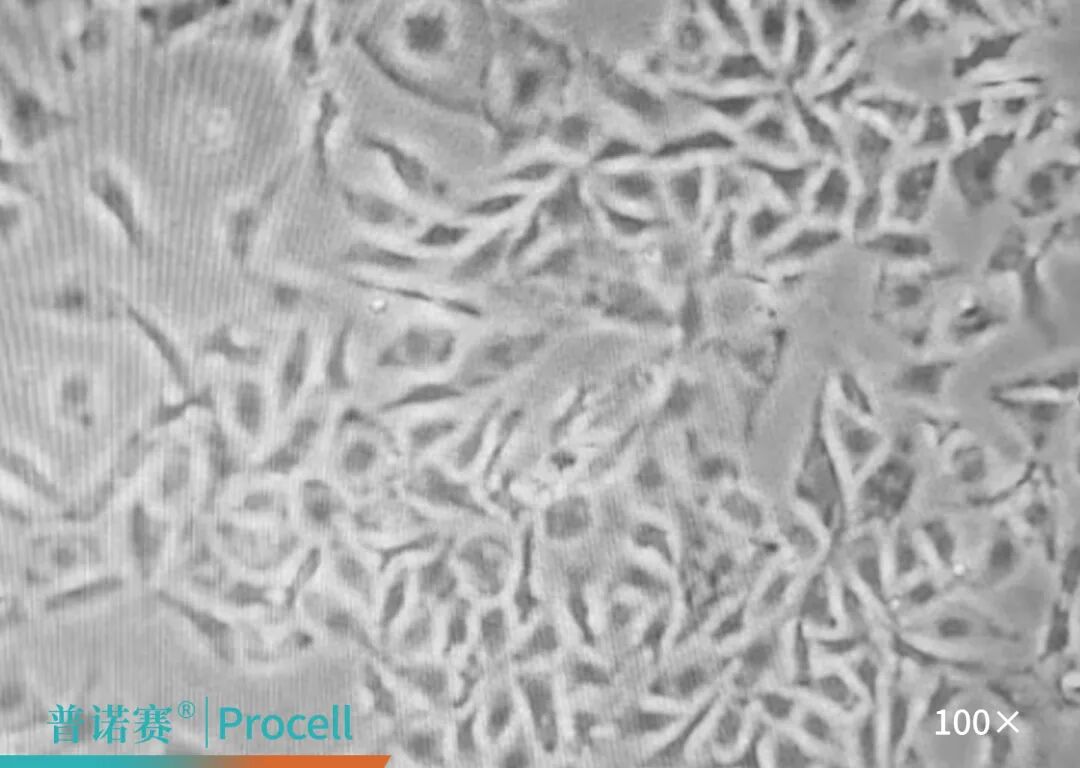 B16-F10细胞支原体清除试剂效果对比-支原体清除剂处理后状态