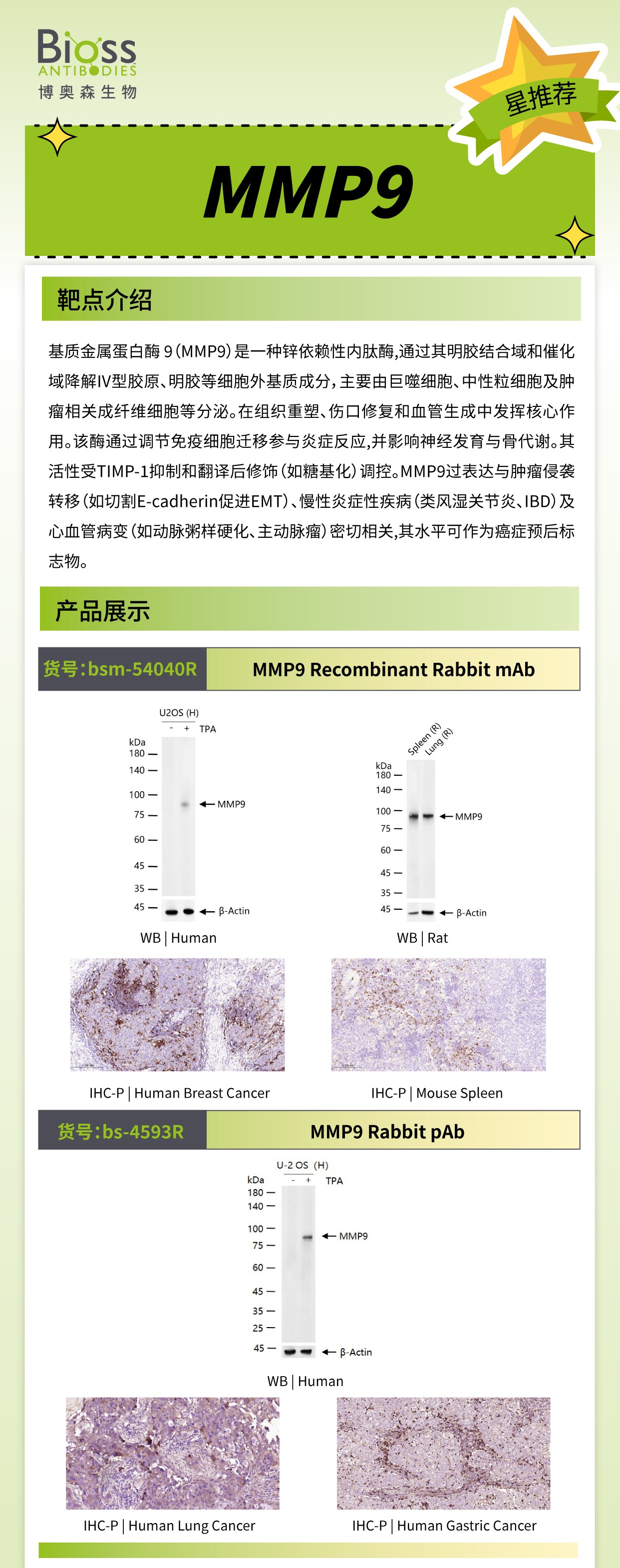 Bioss 星推荐 | MMP9 抗体