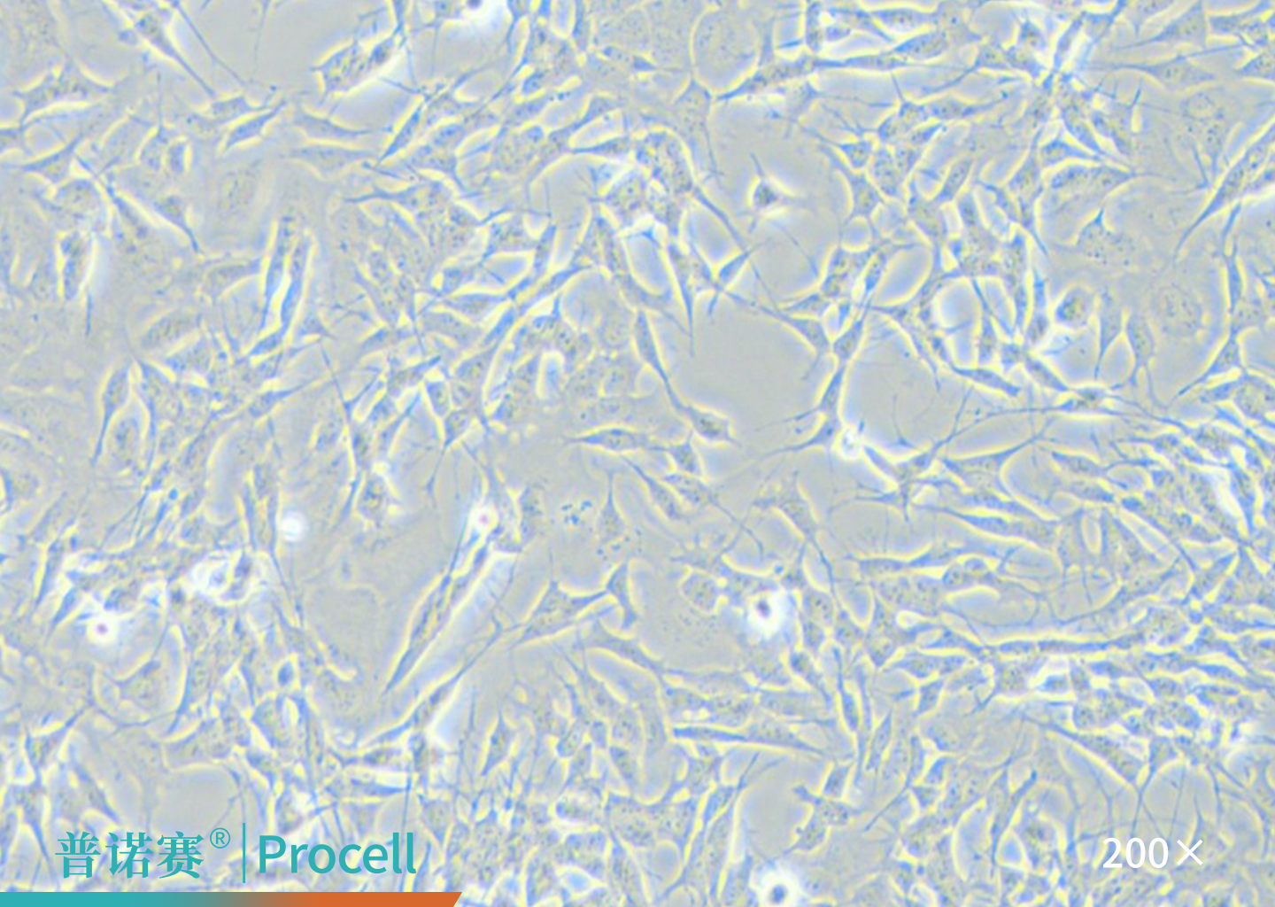 SH-SY5Y细胞的显微镜观察图