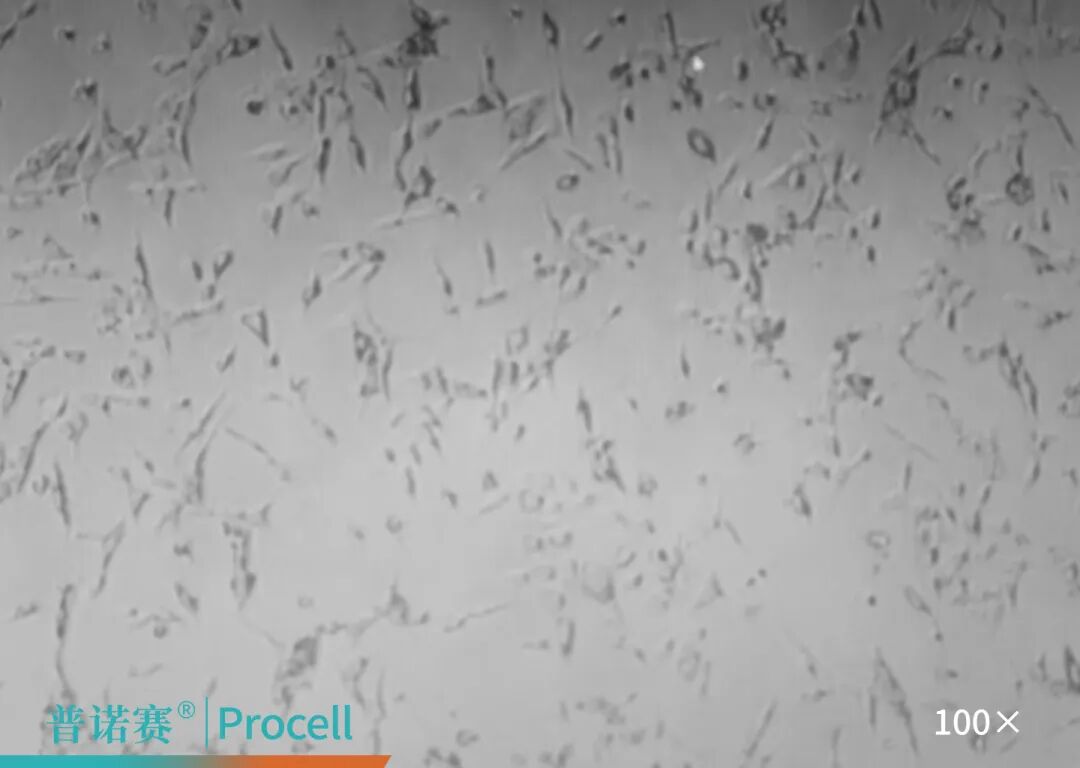 MCF 10A细胞传代后单层贴壁展开