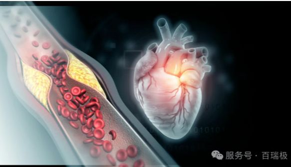 ELISA检测/心血管疾病