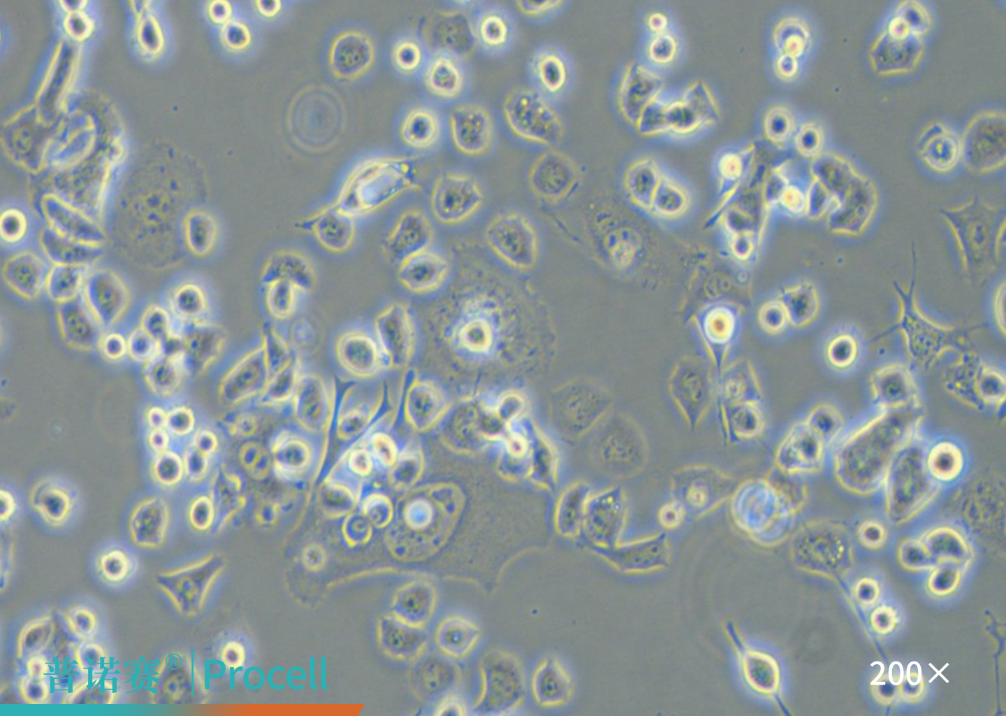 Neuro-2a细胞的显微镜观察图