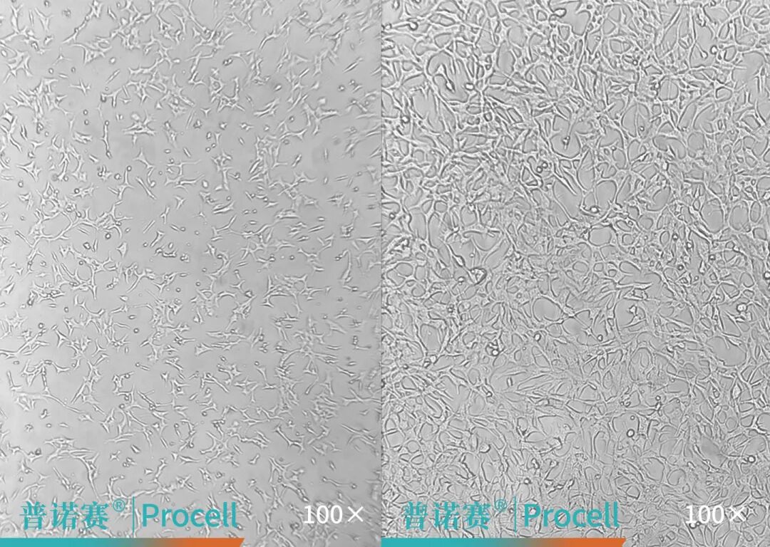 不同培养密度下C8-D1A细胞贴壁形态对比（左：低密度；右：高密度）