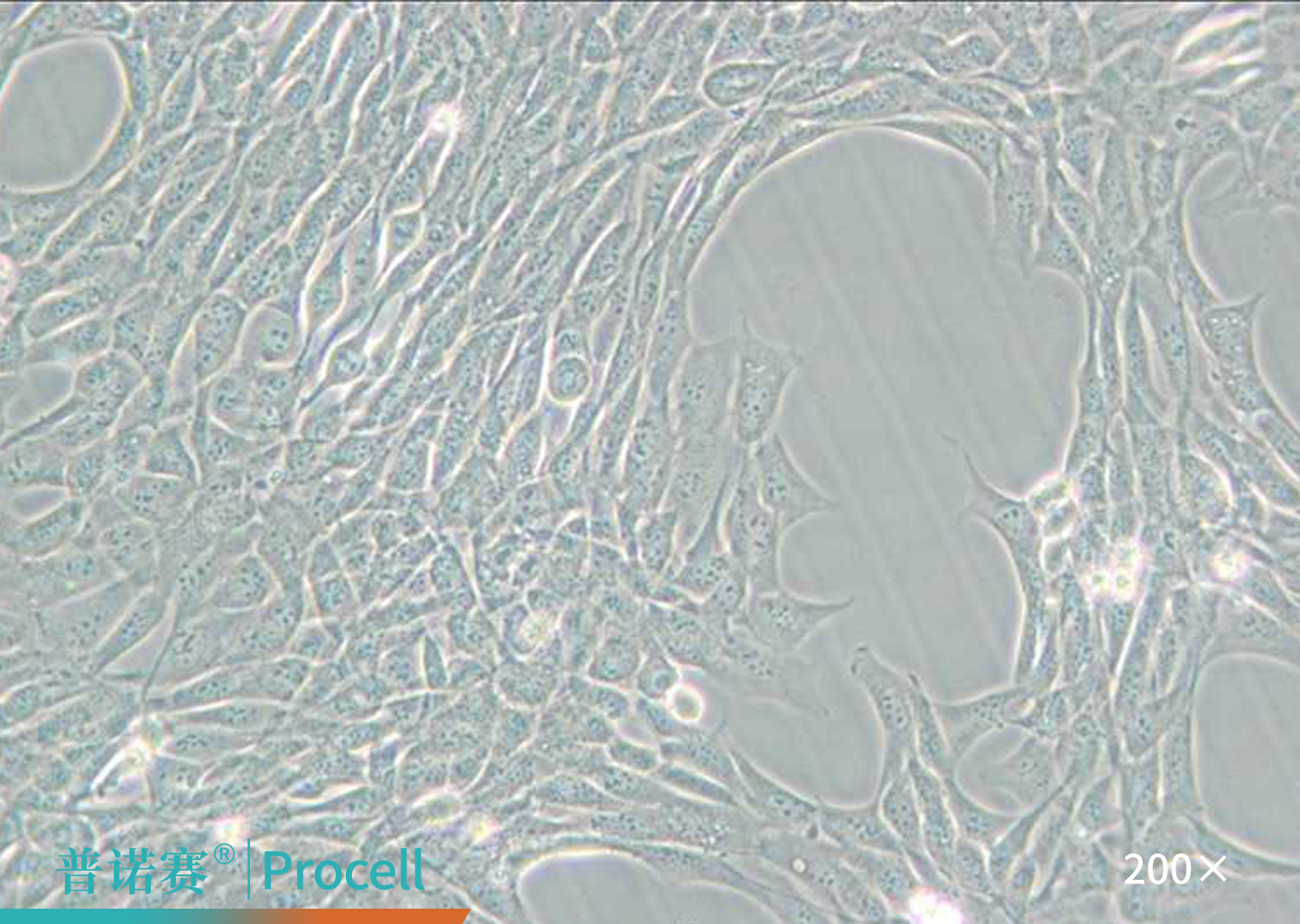 HT22细胞的显微镜观察图