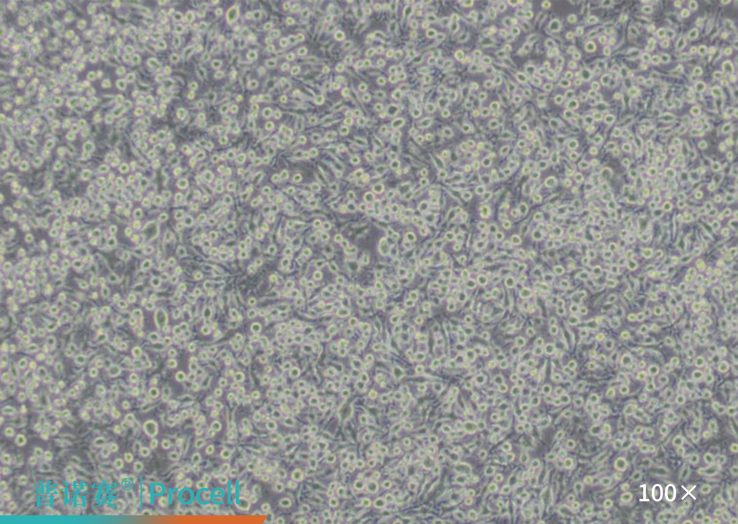 BV-2细胞的显微镜观察图