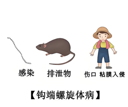 钩端螺旋体 IgG/IgM 快速检测试剂(全血/血清/血浆)