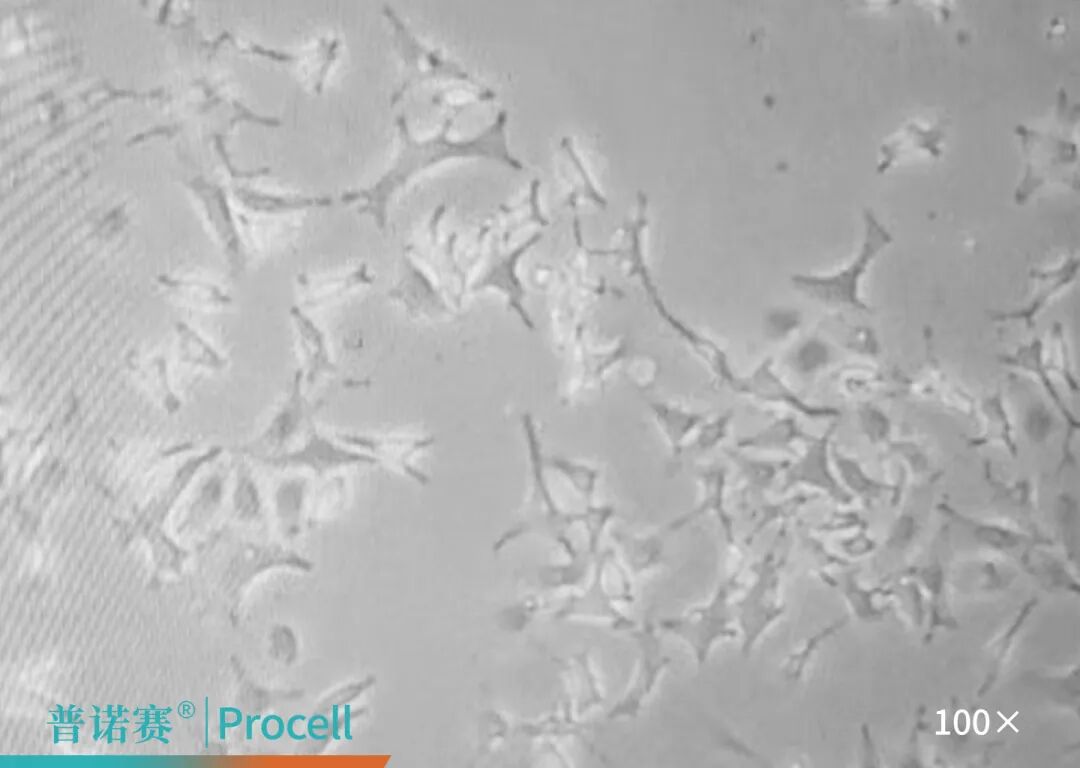 B16-F10细胞支原体清除试剂效果对比-支原体污染状态