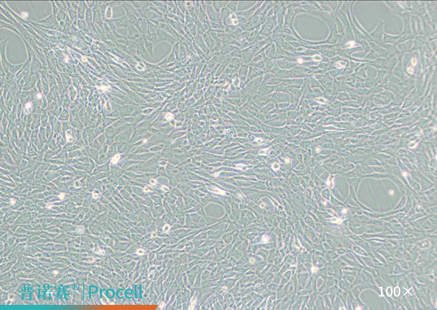 HT22细胞的显微镜观察图