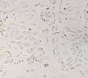 肾小球上皮细胞:肾病药物研发的“黄金靶点”