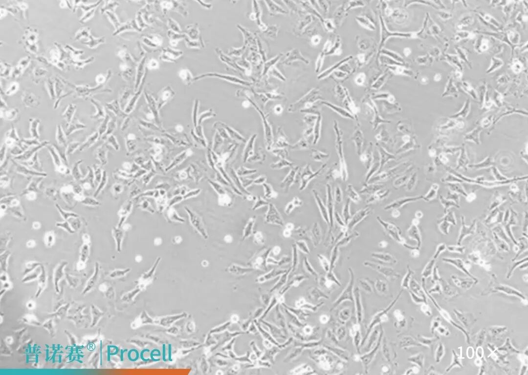 Hela细胞更换血清前图像