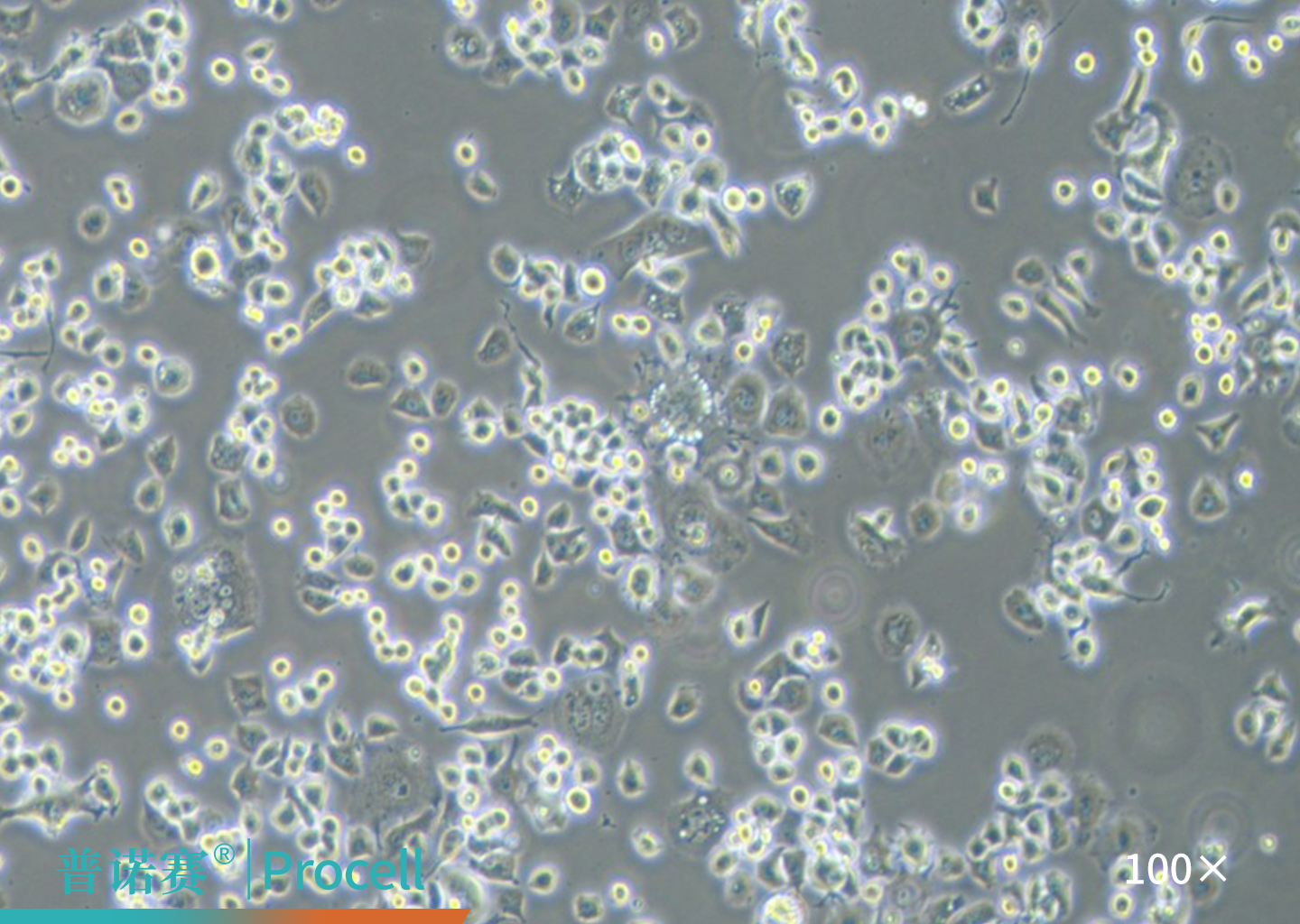 Neuro-2a细胞的显微镜观察图