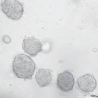 肿瘤原代CAF细胞提取