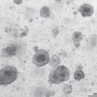 人肿瘤类器官模型构建