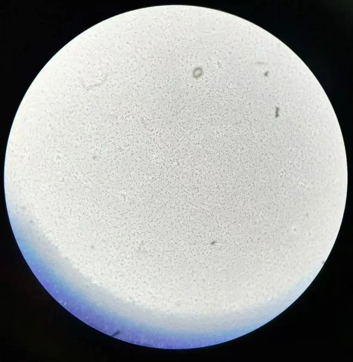 血清使用常见问题及应对方法