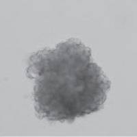 人血管化肿瘤类器官模型构建