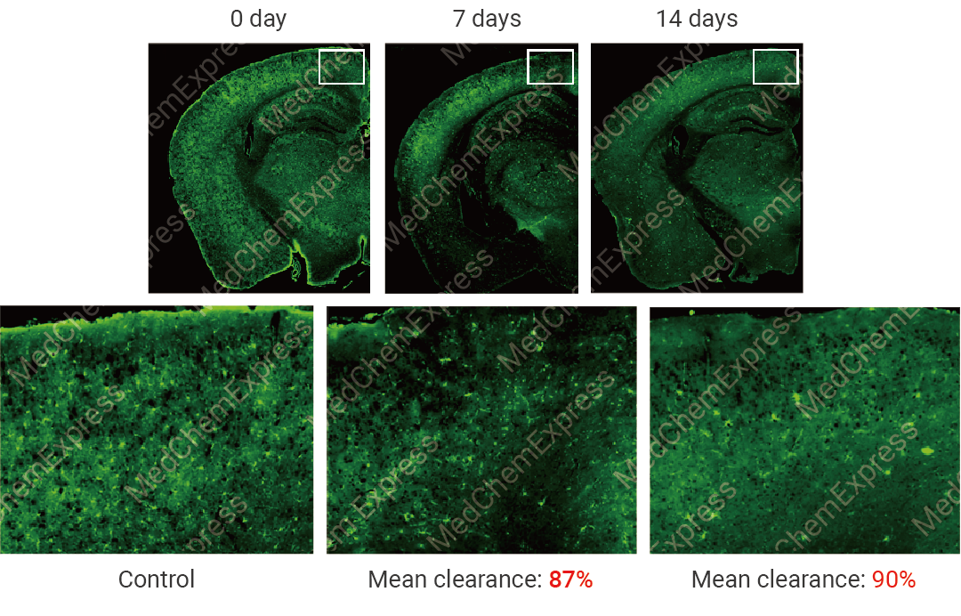 国自然热点 ｜ “静息”是误解 “M1M2” 已过时 最热的小胶质细胞耗竭, 你必须了解