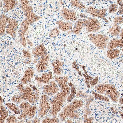 小分子药物机制研究(IF/IHC)