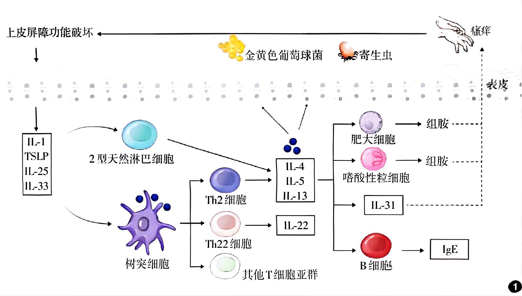 特应性皮炎：发病机制解析与治疗演进