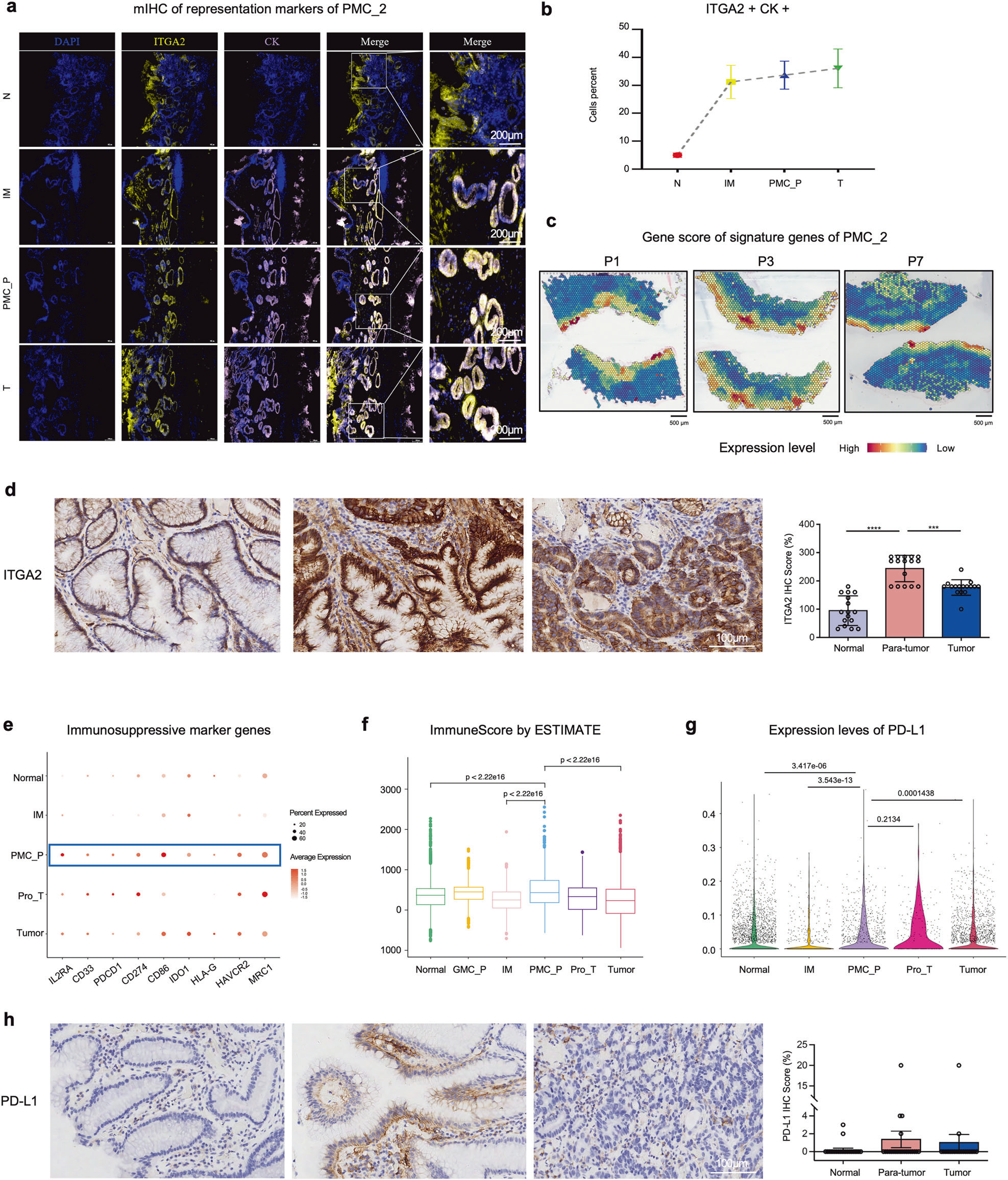 STTT| Tissue Cytometry技术 “解码” 胃癌前关键互作,让 PMC_P 微环境从 【数据猜想】变 【可视化证据】