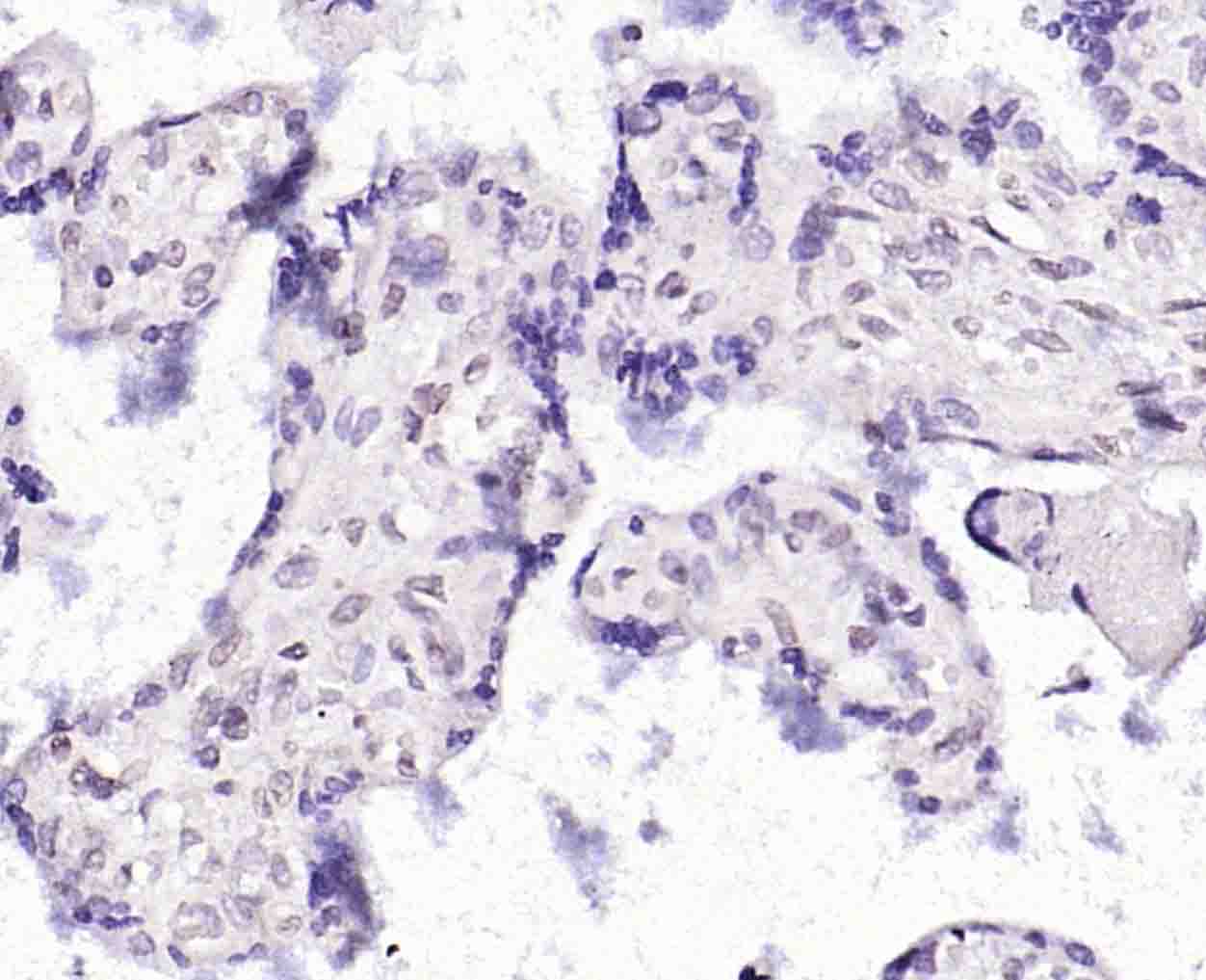 MAGEA4 Rabbit pAb(bs-3645R)-50