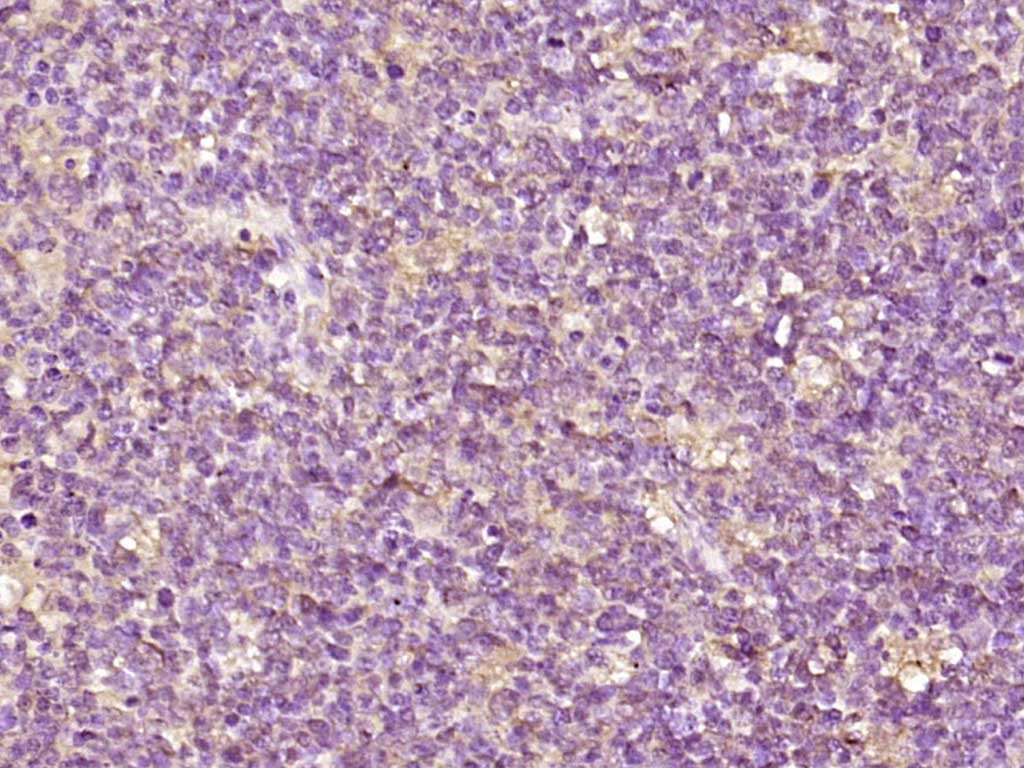 EDC4 Rabbit pAb(bs-10953R)-50u