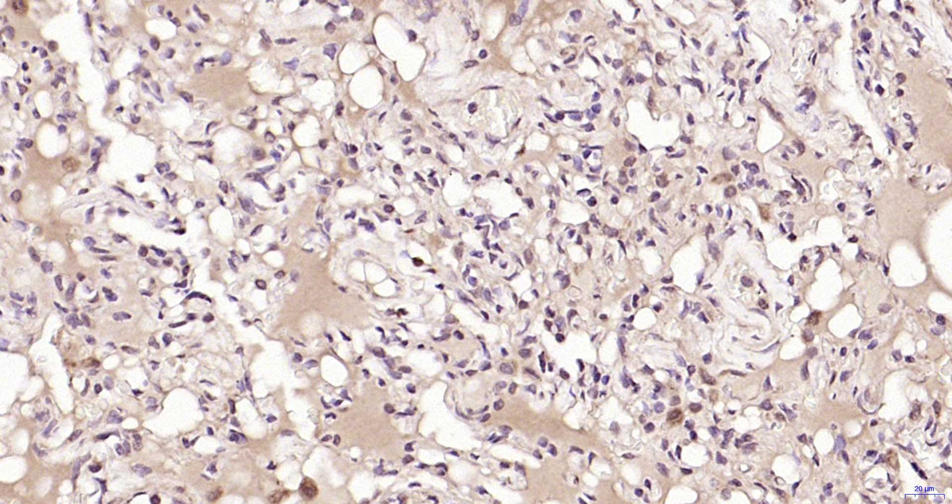 PSME3 Rabbit pAb(bs-4222R)-50u