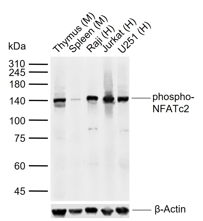 phospho-NFATc2 (Ser330) Rabbit